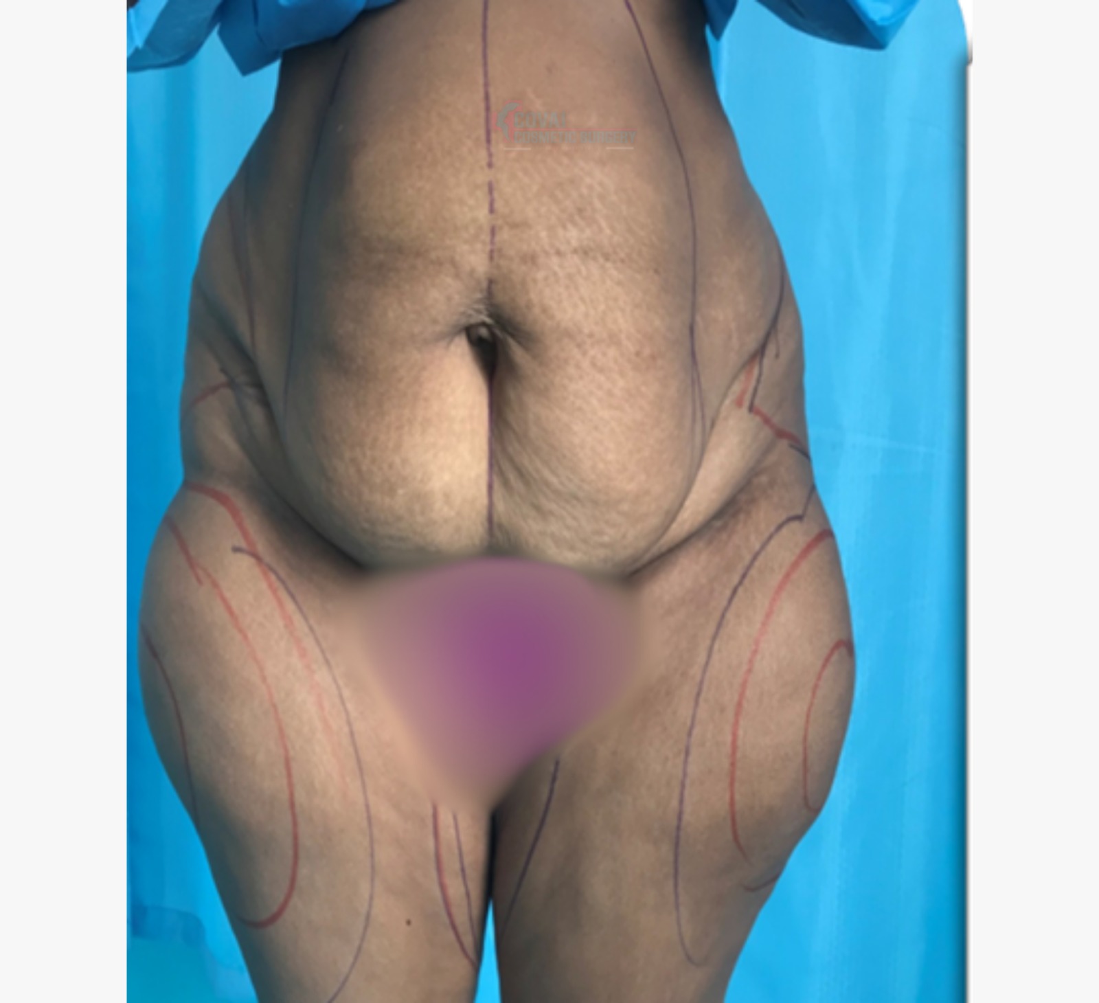 Transformation Case 6