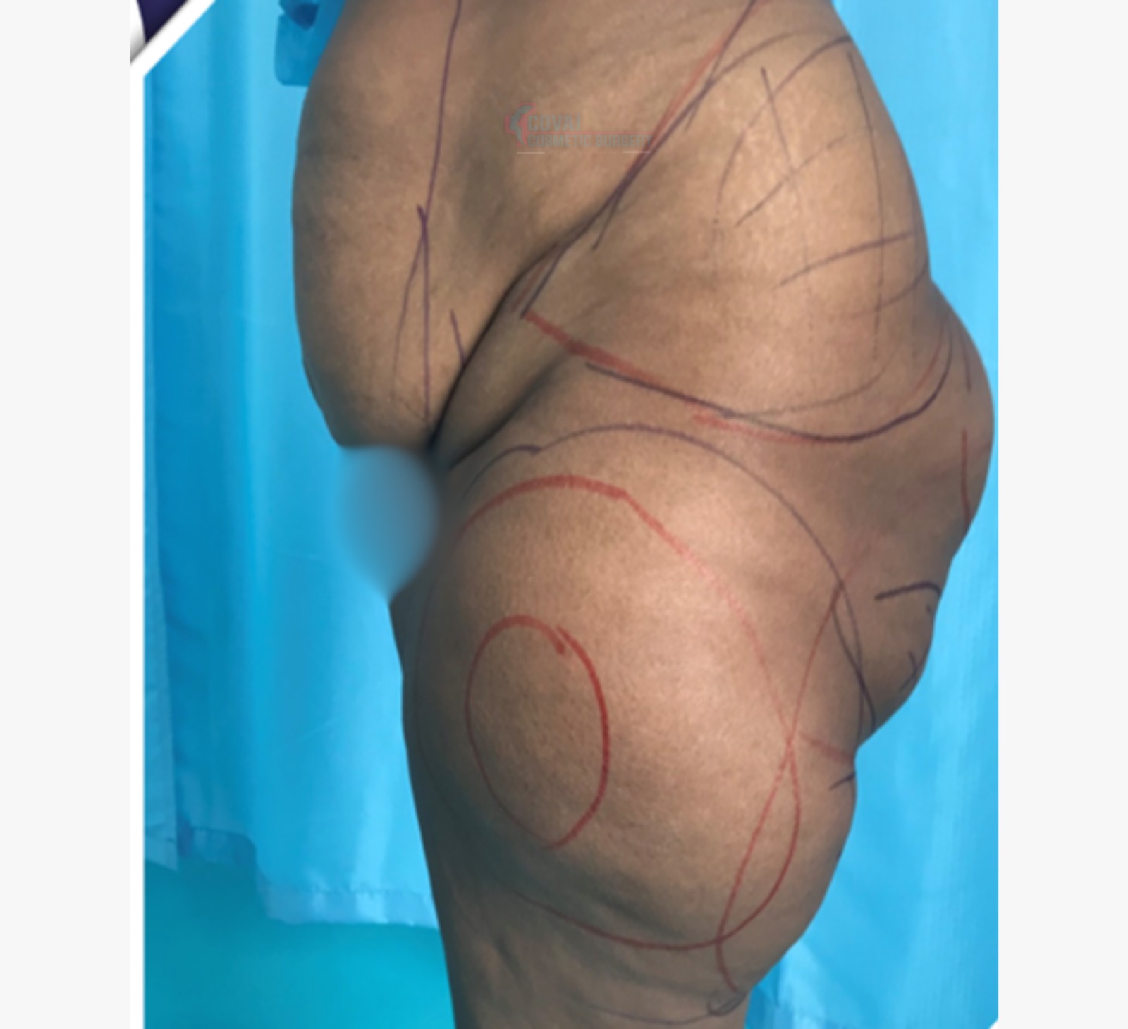 Transformation Case 7